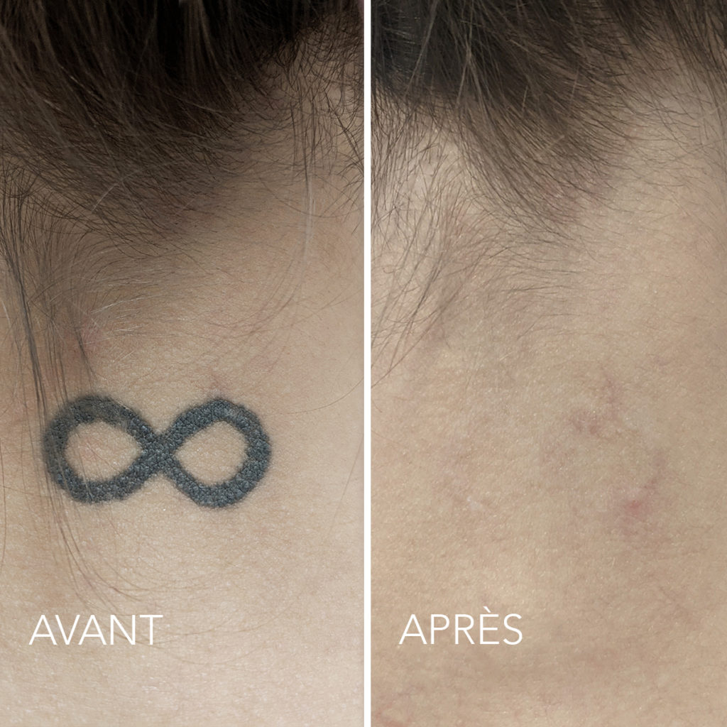 Clinique d'esthétique médicale de préférence à Montréal Dermamode